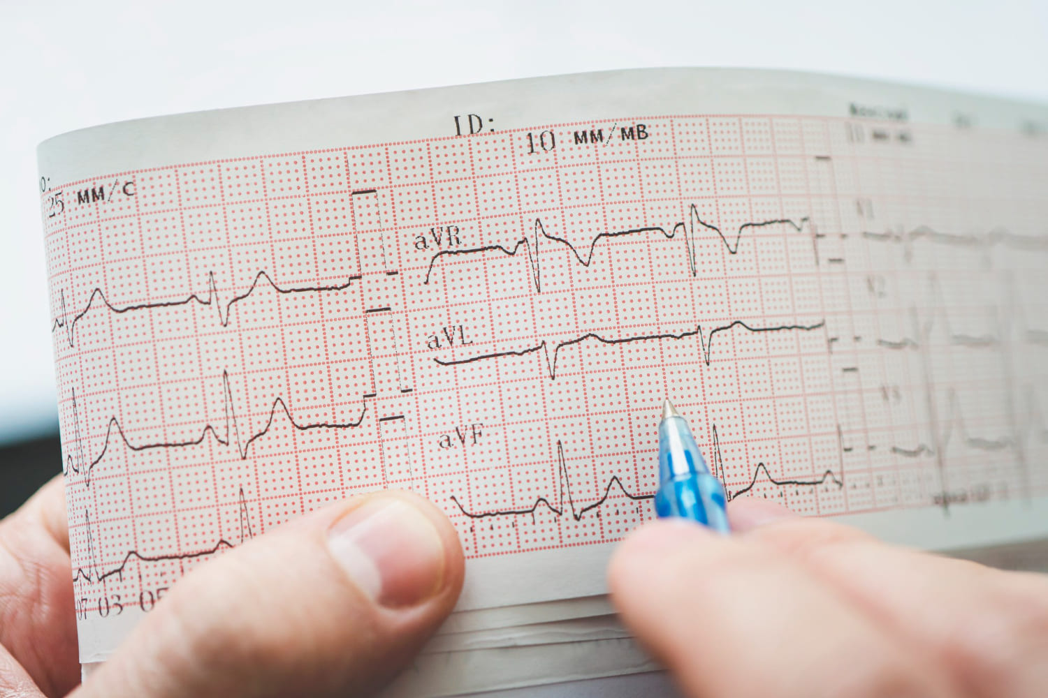 Electrocardiograma pediátrico en Puebla: diagnóstico preciso del corazón de tu hijo